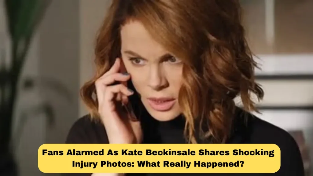 Fans Alarmed as Kate Beckinsale Shares Shocking Injury Photos What Really Happened